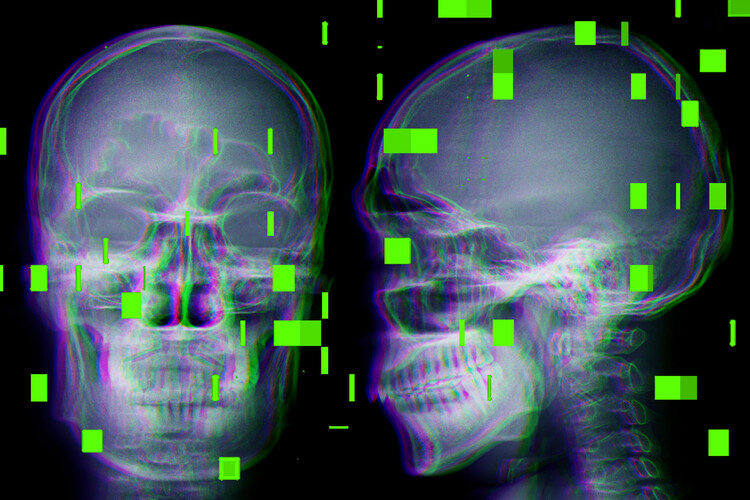 Ciemna strona AI w medycynie: raport o błędach w salach operacyjnych